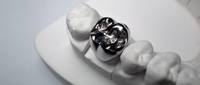 Стоматология о зубных коронках из металла