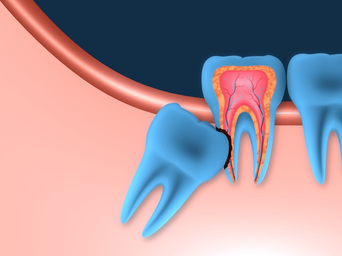 Сколько каналов в зубах у человека?